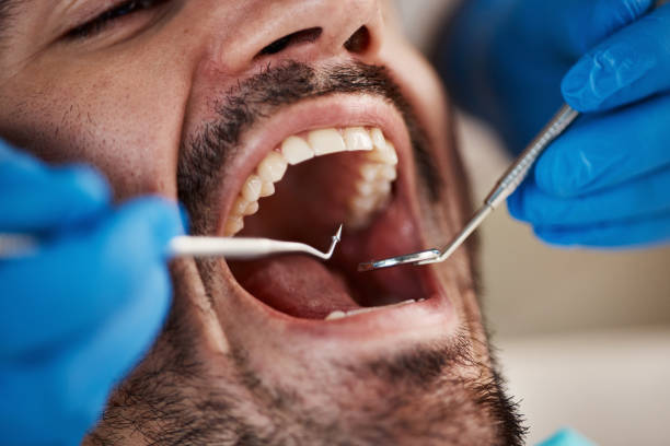 Best Emergency Treatment for Oral Infections in Colby, KS